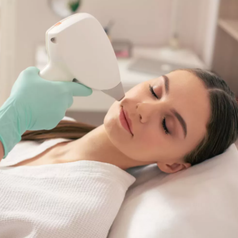 lazer service foto canva